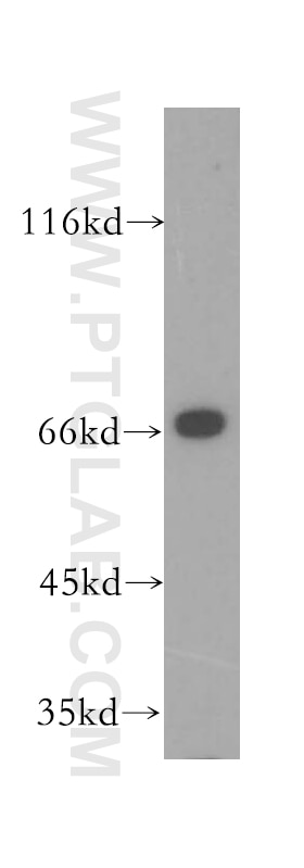 Western Blot (WB) analysis of HeLa cells using IMP5 Polyclonal antibody (12664-1-AP)