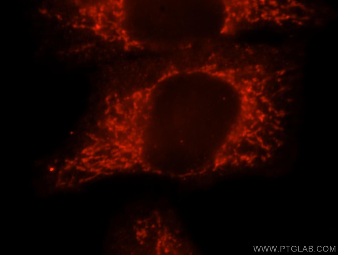 Immunofluorescence (IF) / fluorescent staining of HepG2 cells using IMPA1 Polyclonal antibody (16593-1-AP)