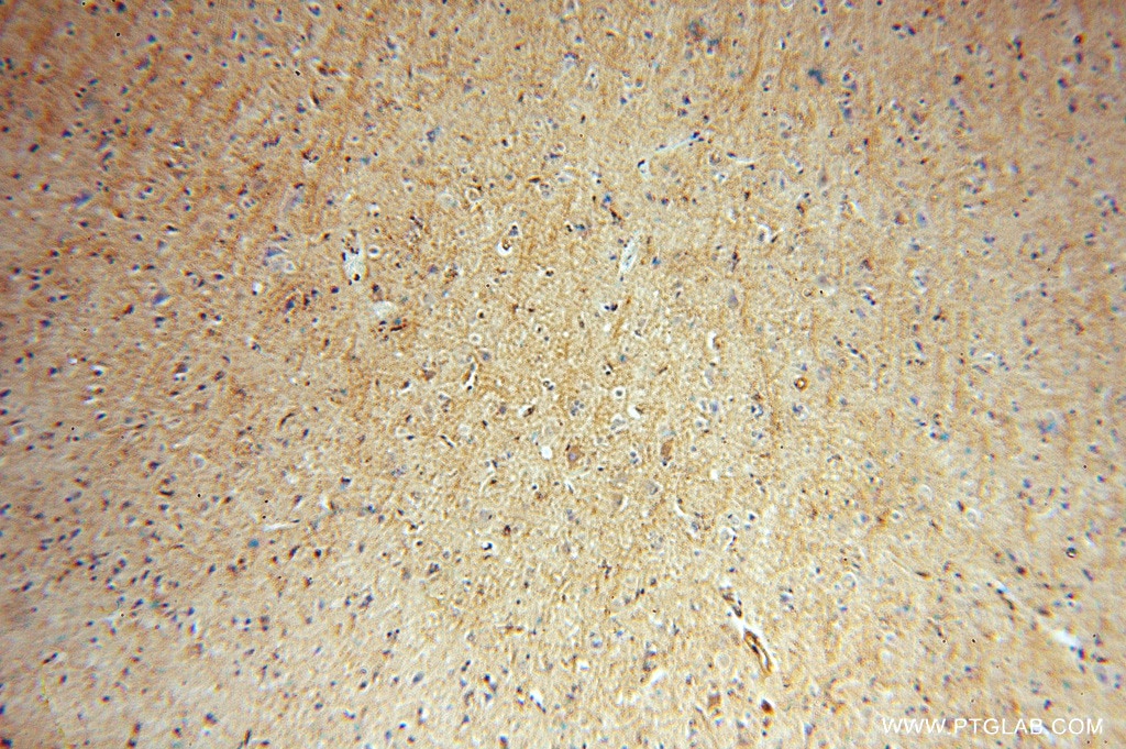 Immunohistochemistry (IHC) staining of human brain tissue using IMPA1 Polyclonal antibody (16593-1-AP)