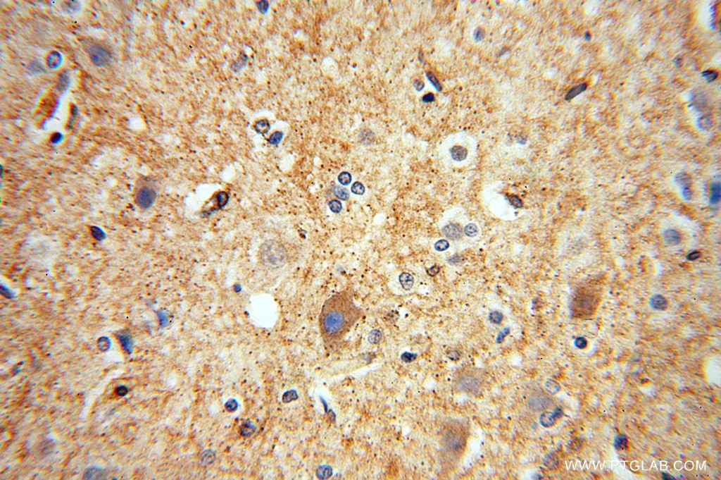 Immunohistochemistry (IHC) staining of human brain tissue using IMPA1 Polyclonal antibody (16593-1-AP)
