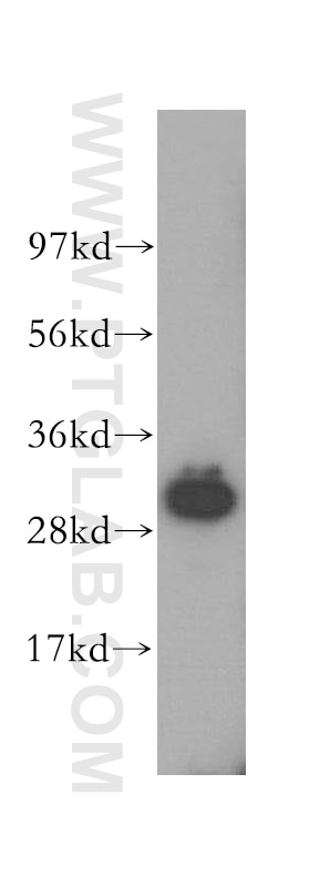 Western Blot (WB) analysis of human kidney tissue using IMPA1 Polyclonal antibody (16593-1-AP)