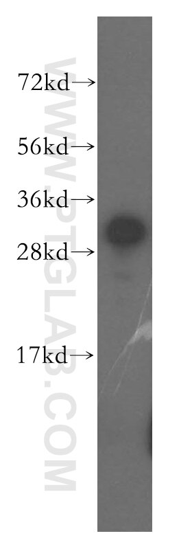 Western Blot (WB) analysis of human brain tissue using IMPA1 Polyclonal antibody (16593-1-AP)