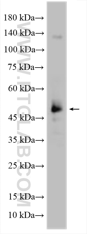Western Blot (WB) analysis of TT cells using IMPACT Polyclonal antibody (16528-1-AP)