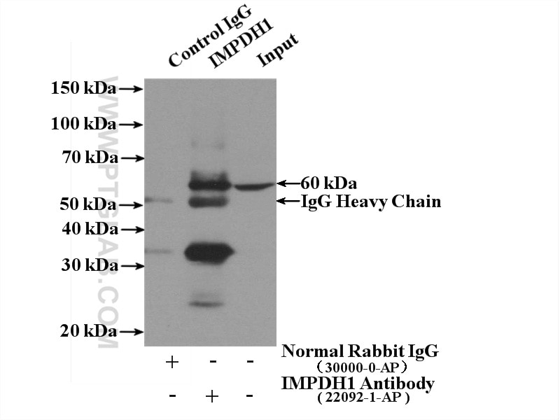 IP experiment of HeLa using 22092-1-AP