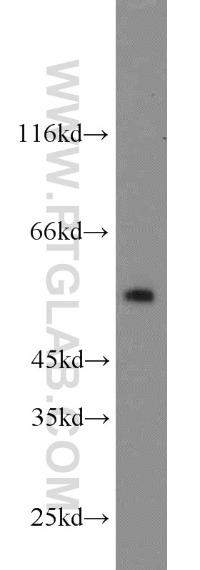 Western Blot (WB) analysis of HeLa cells using IMPDH1 Polyclonal antibody (22092-1-AP)