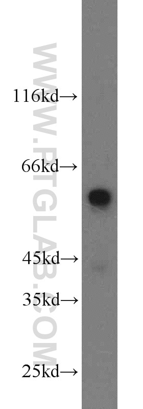 Western Blot (WB) analysis of mouse spleen tissue using IMPDH1 Polyclonal antibody (22092-1-AP)