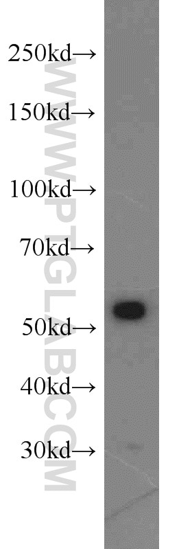 Western Blot (WB) analysis of A431 cells using IMPDH1 Polyclonal antibody (22092-1-AP)