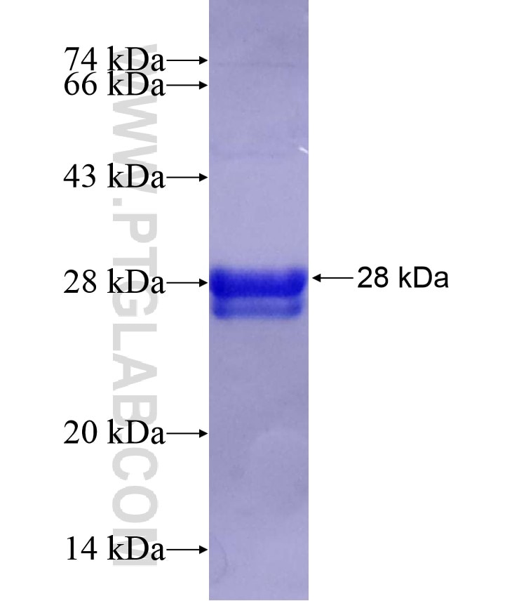 IMPDH1 fusion protein Ag17297 SDS-PAGE