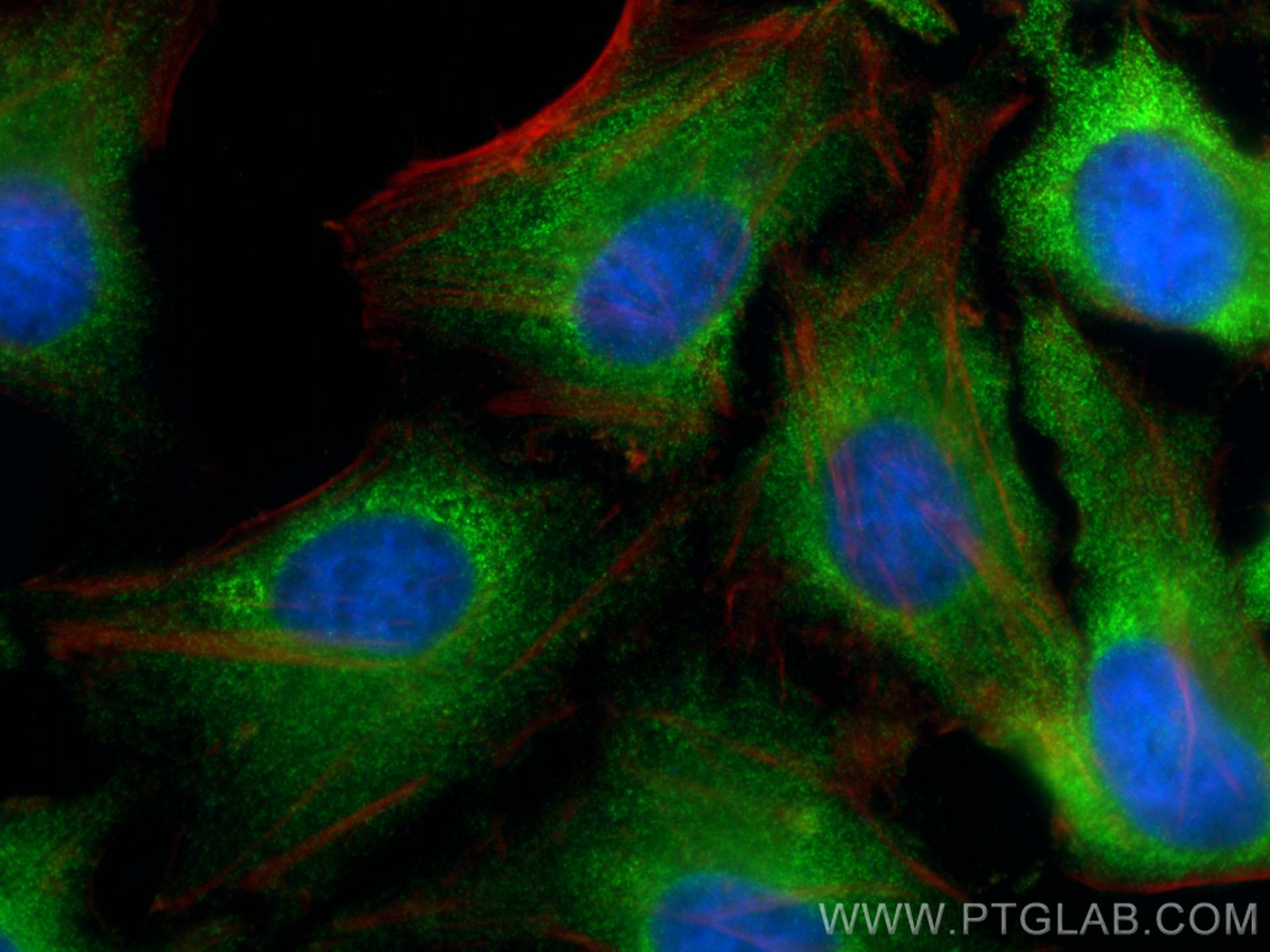 Immunofluorescence (IF) / fluorescent staining of HeLa cells using IMPDH2 Polyclonal antibody (12948-1-AP)