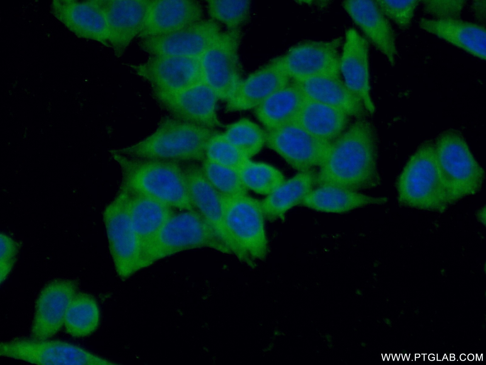 Immunofluorescence (IF) / fluorescent staining of HeLa cells using IMPDH2 Polyclonal antibody (12948-1-AP)