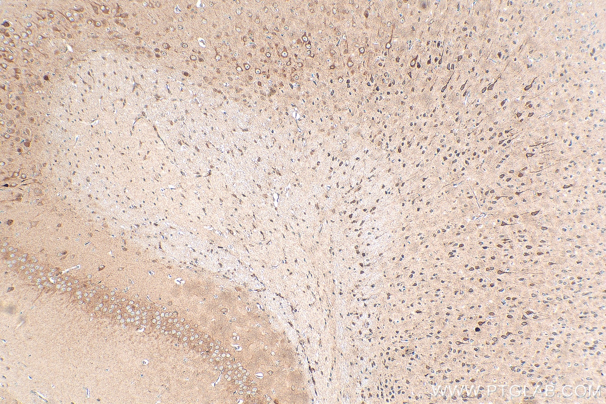 Immunohistochemistry (IHC) staining of mouse brain tissue using IMPDH2 Polyclonal antibody (12948-1-AP)