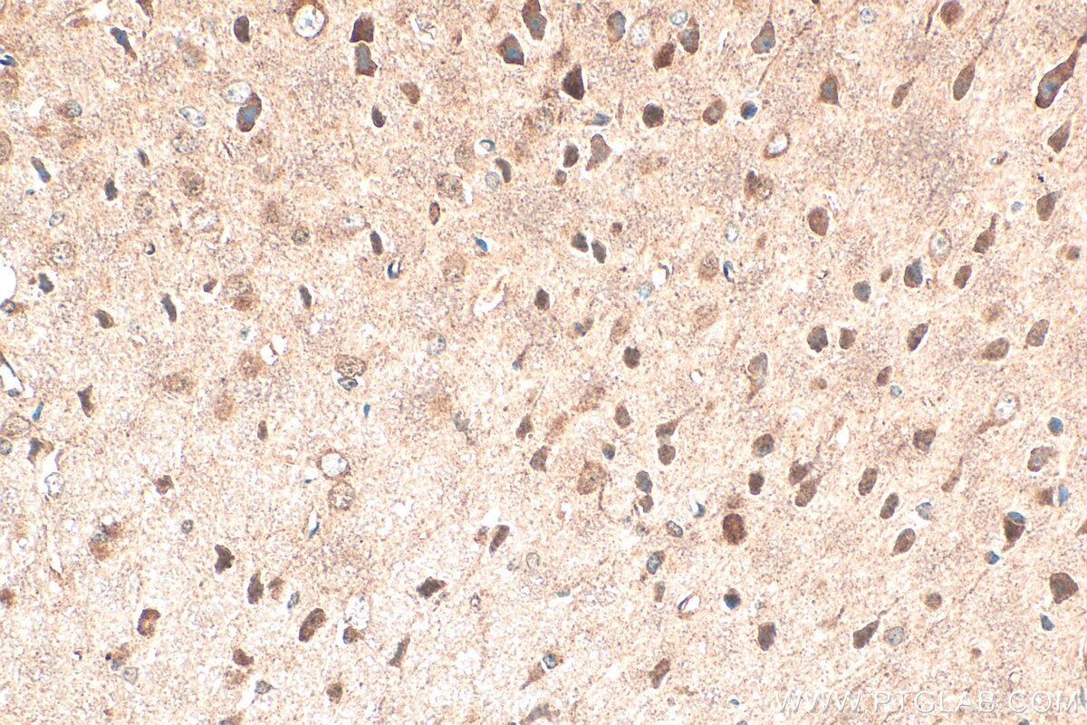 Immunohistochemistry (IHC) staining of mouse brain tissue using IMPDH2 Polyclonal antibody (12948-1-AP)