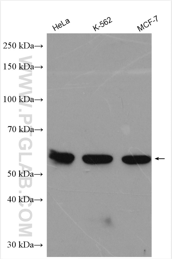 WB analysis using 12948-1-AP