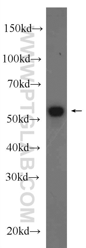 Western Blot (WB) analysis of rat heart tissue using IMPDH2 Polyclonal antibody (12948-1-AP)