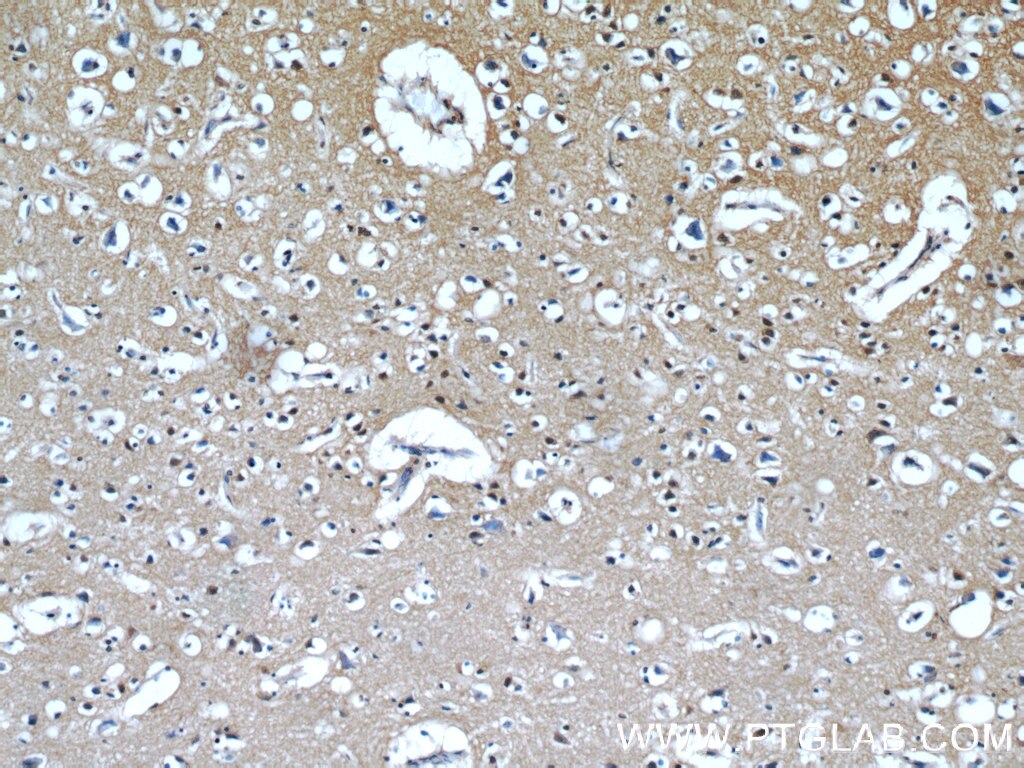 Immunohistochemistry (IHC) staining of human brain tissue using IMPDH2-specific  Polyclonal antibody (55398-1-AP)