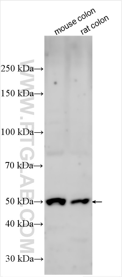 Western Blot (WB) analysis of various lysates using IMPDH2-specific  Polyclonal antibody (55398-1-AP)