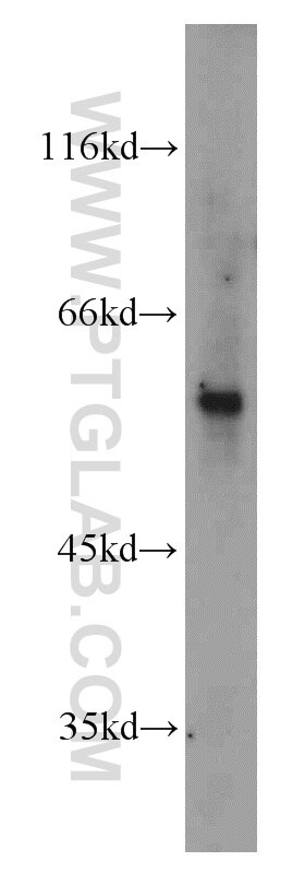 Western Blot (WB) analysis of mouse skeletal muscle tissue using IMPDH2-specific  Polyclonal antibody (55398-1-AP)