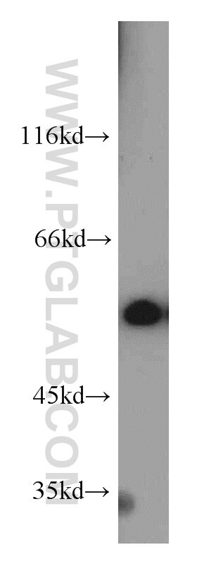 Western Blot (WB) analysis of K-562 cells using IMPDH2-specific  Polyclonal antibody (55398-1-AP)