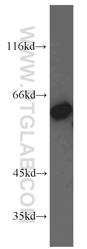 Western Blot (WB) analysis of A549 cells using IMPDH2-specific  Polyclonal antibody (55398-1-AP)