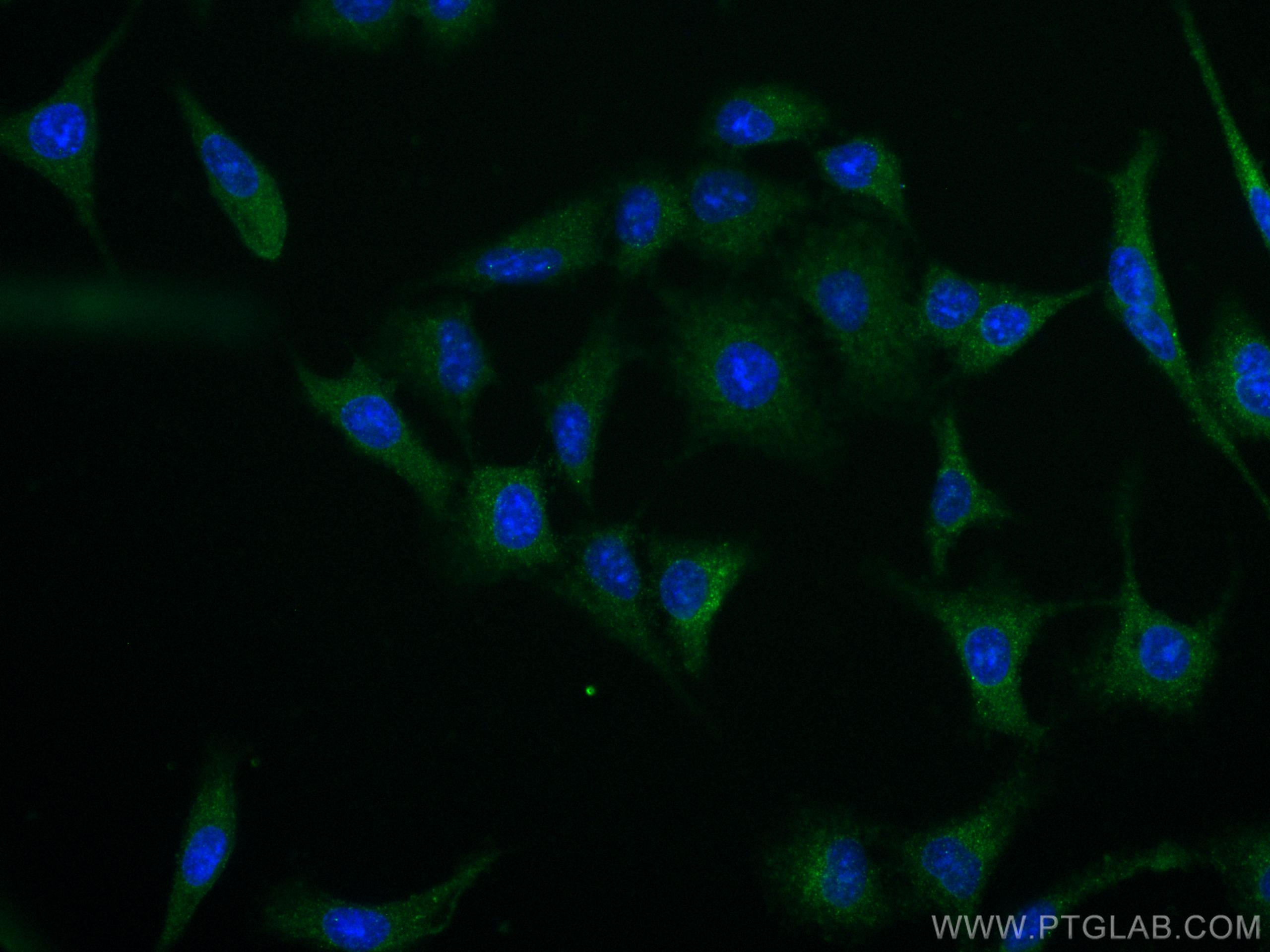 Immunofluorescence (IF) / fluorescent staining of A549 cells using IMPDH2 Monoclonal antibody (67663-1-Ig)