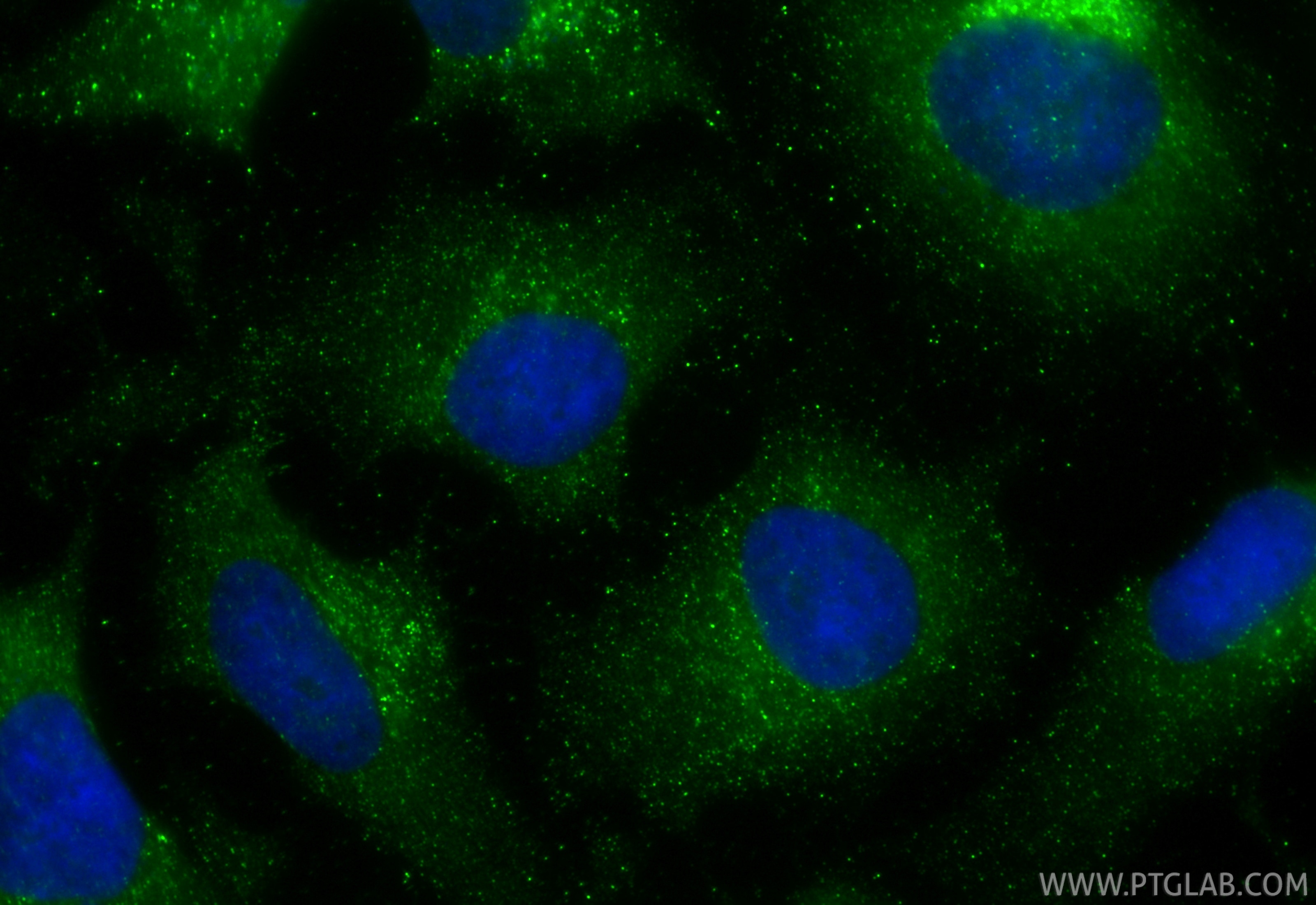 Immunofluorescence (IF) / fluorescent staining of HeLa cells using IMPDH2 Monoclonal antibody (67663-1-Ig)
