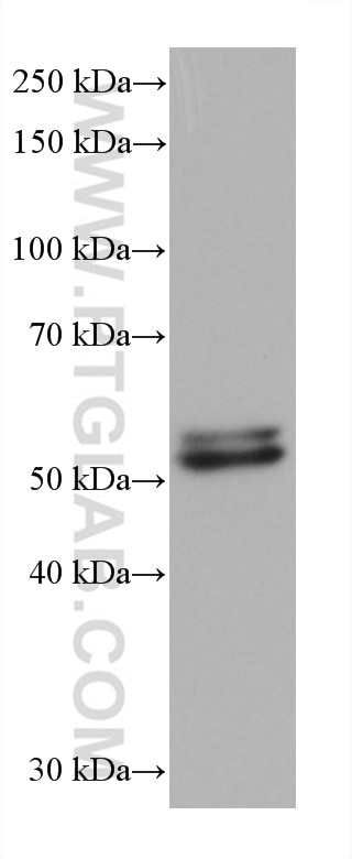 Western Blot (WB) analysis of 4T1 cells using IMPDH2 Monoclonal antibody (67663-1-Ig)