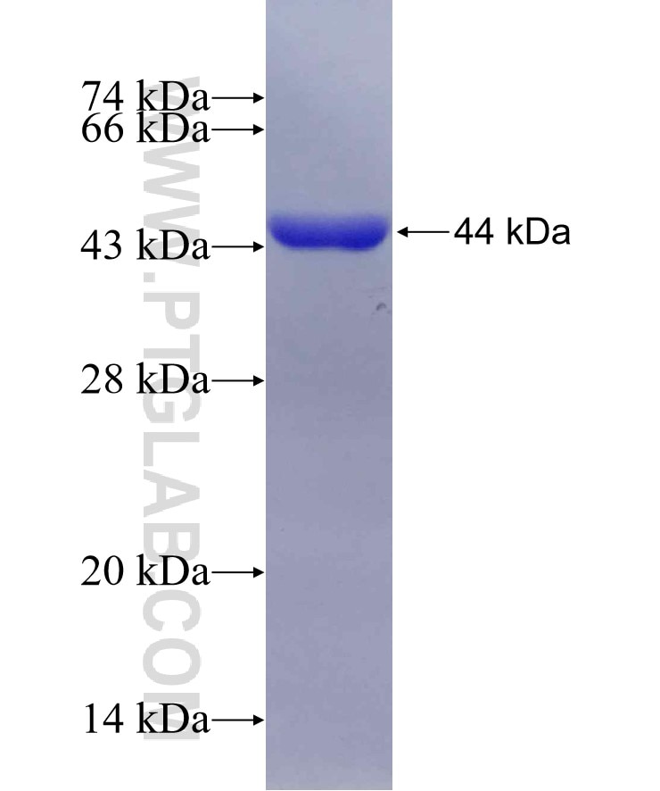 IMPDH2 fusion protein Ag17170 SDS-PAGE