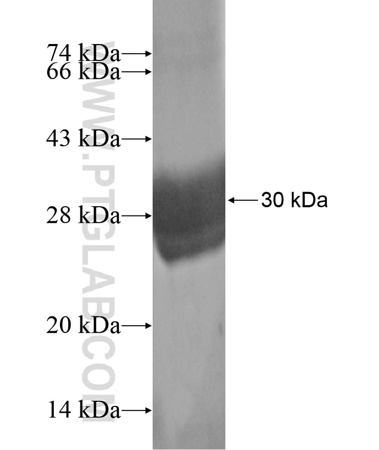 IMPDH2 fusion protein Ag17296 SDS-PAGE