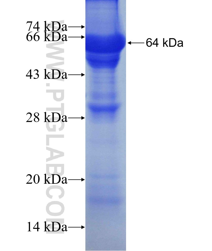 IMPDH2 fusion protein Ag3632 SDS-PAGE