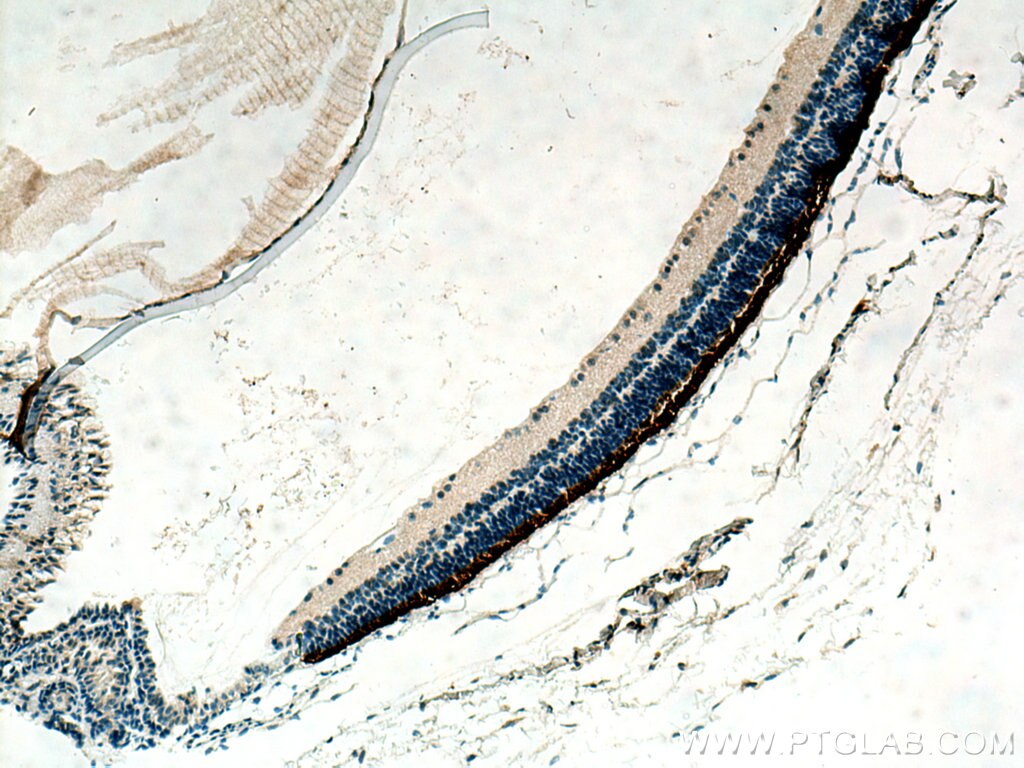 Immunohistochemistry (IHC) staining of mouse eye tissue using IMPG1 Polyclonal antibody (19895-1-AP)