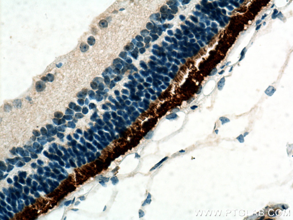 Immunohistochemistry (IHC) staining of mouse eye tissue using IMPG1 Polyclonal antibody (19895-1-AP)