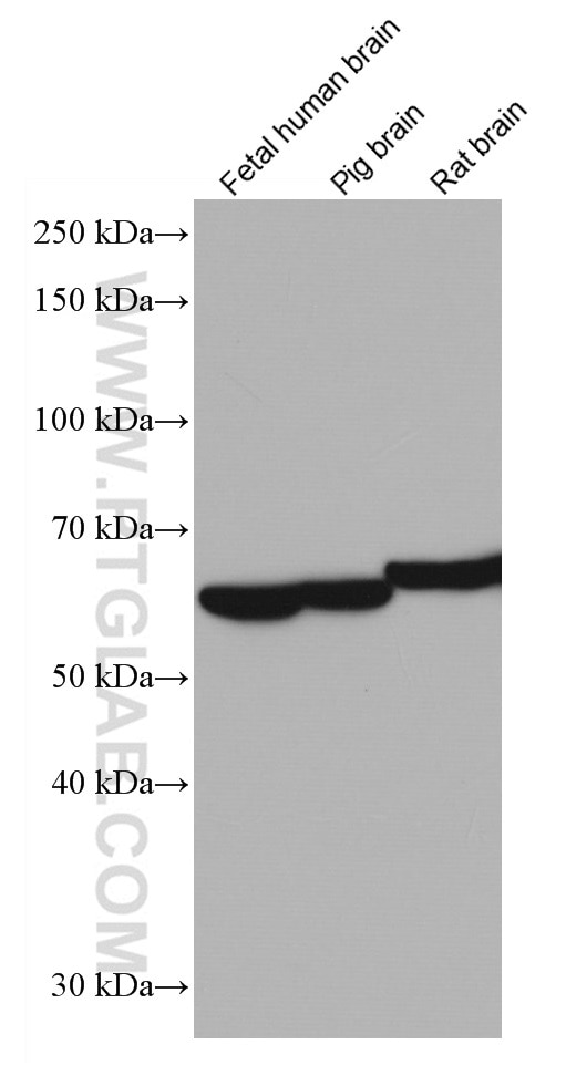 Western Blot (WB) analysis of various lysates using INA Monoclonal antibody (67120-1-Ig)