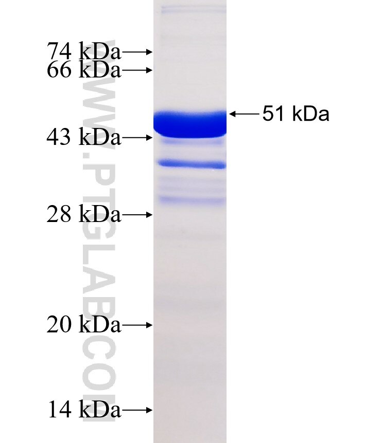 INCA1 fusion protein Ag27997 SDS-PAGE