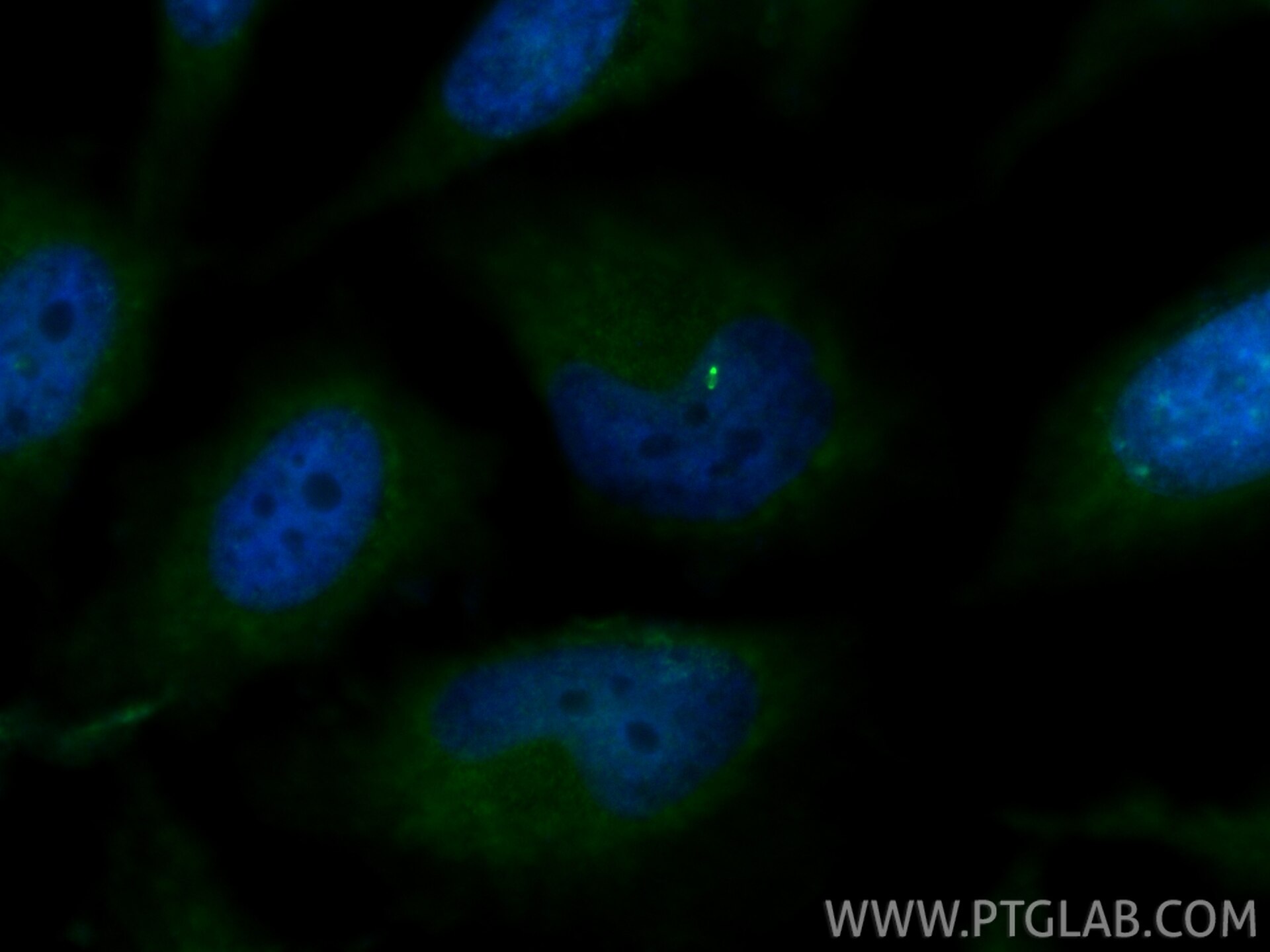 Immunofluorescent analysis of (4% PFA) fixed HeLa cells using INCENP antibody (29419-1-AP) at dilution of 1:200 and CoraLite®488-Conjugated Goat Anti-Rabbit IgG(H+L) (SA00013-2). Immunofluorescence (IF) / fluorescent staining of HeLa cells using INCENP Polyclonal antibody (29419-1-AP)