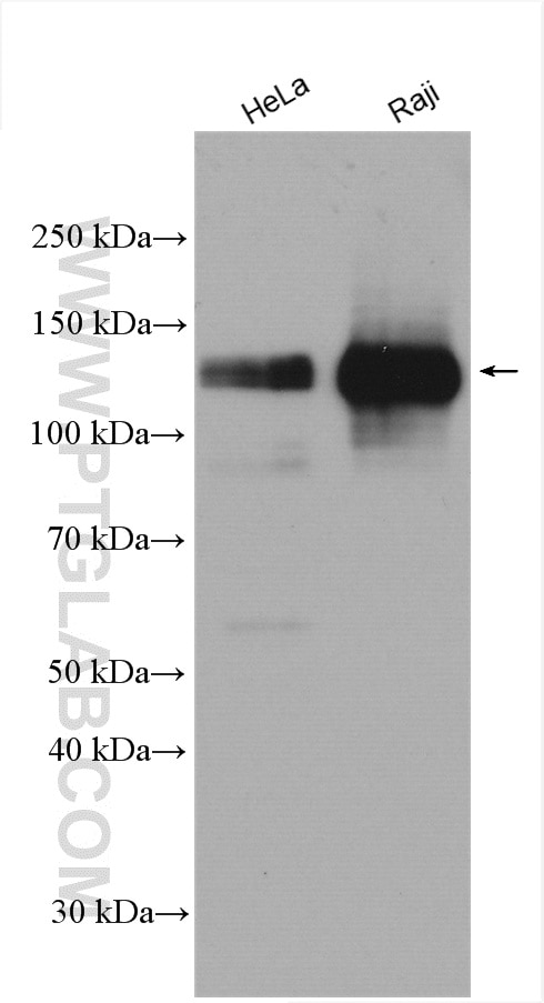 Western Blot (WB) analysis of various lysates using INCENP Polyclonal antibody (29419-1-AP)