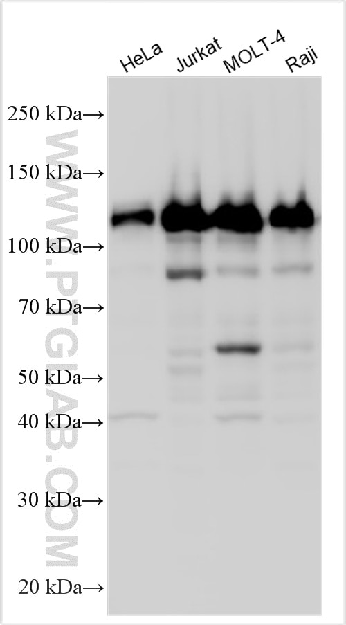 Western Blot (WB) analysis of various lysates using INCENP Polyclonal antibody (29419-1-AP)