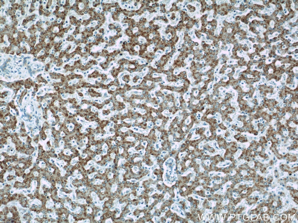 Immunohistochemistry (IHC) staining of human liver tissue using INE1 Polyclonal antibody (21340-1-AP)