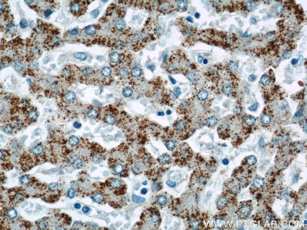 Immunohistochemistry (IHC) staining of human liver tissue using INE1 Polyclonal antibody (21340-1-AP)