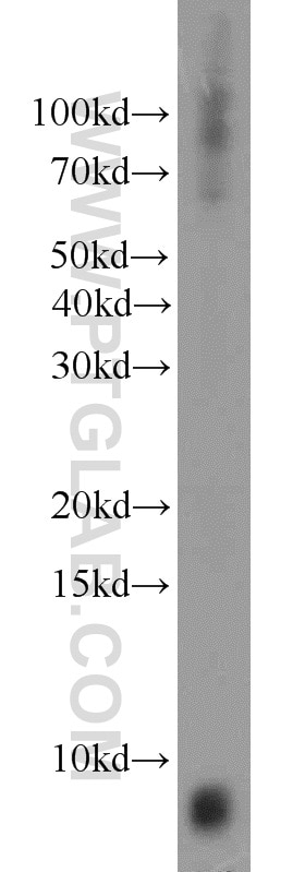 Western Blot (WB) analysis of human brain tissue using INE1 Polyclonal antibody (21340-1-AP)