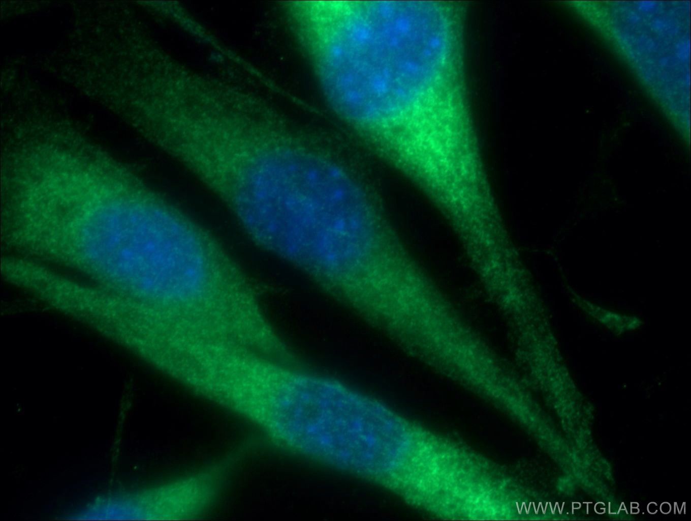 Immunofluorescence (IF) / fluorescent staining of NIH/3T3 cells using INF2 Polyclonal antibody (20466-1-AP)