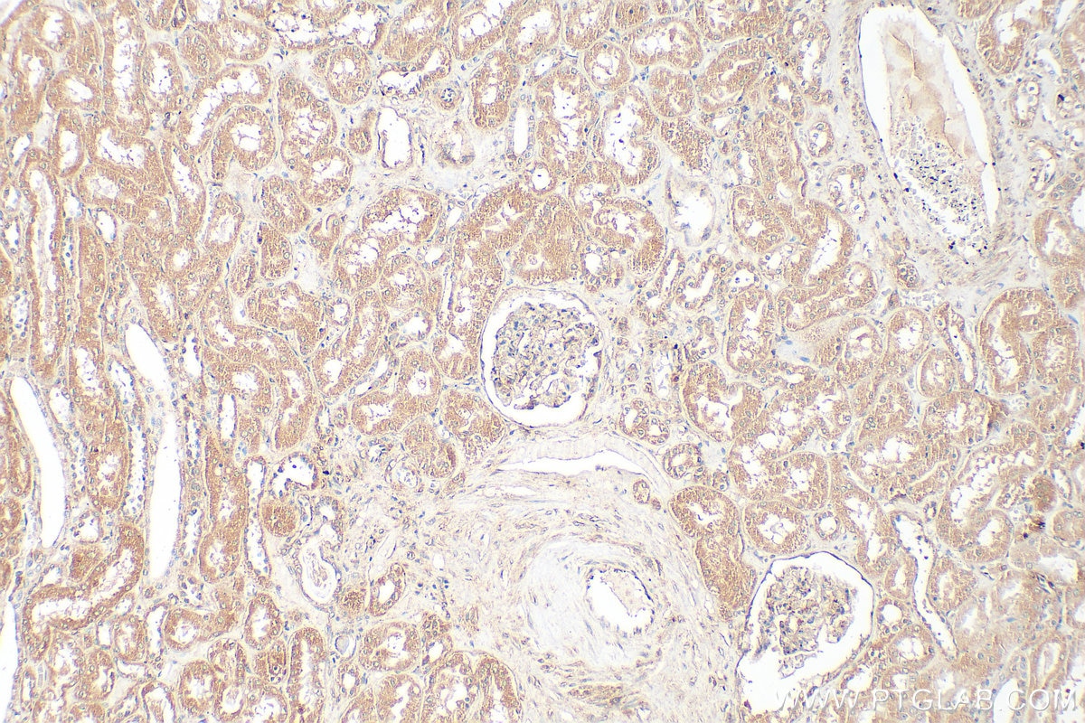 Immunohistochemical analysis of paraffin-embedded human kidney tissue slide using 20466-1-AP (INF2 antibody) at dilution of 1:400 (under 10x lens). Heat mediated antigen retrieval with Tris-EDTA buffer (pH 9.0). Immunohistochemistry (IHC) staining of human kidney tissue using INF2 Polyclonal antibody (20466-1-AP)