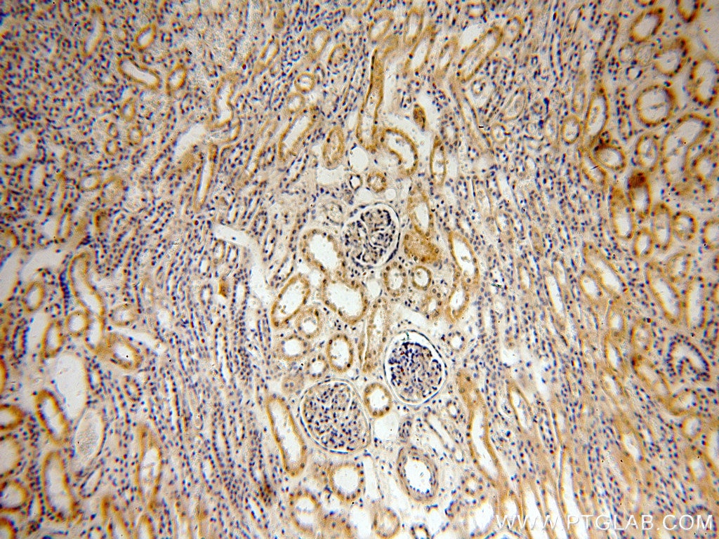 Immunohistochemistry (IHC) staining of human kidney tissue using INF2 Polyclonal antibody (20466-1-AP)
