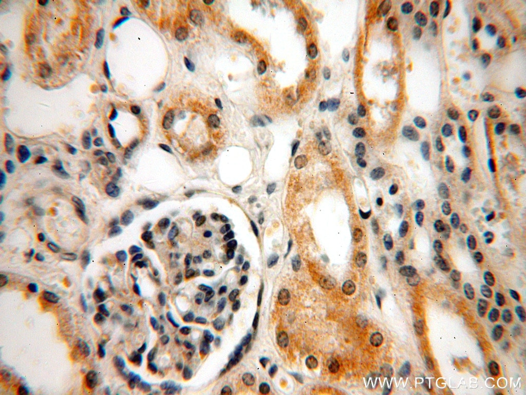 Immunohistochemistry (IHC) staining of human kidney tissue using INF2 Polyclonal antibody (20466-1-AP)