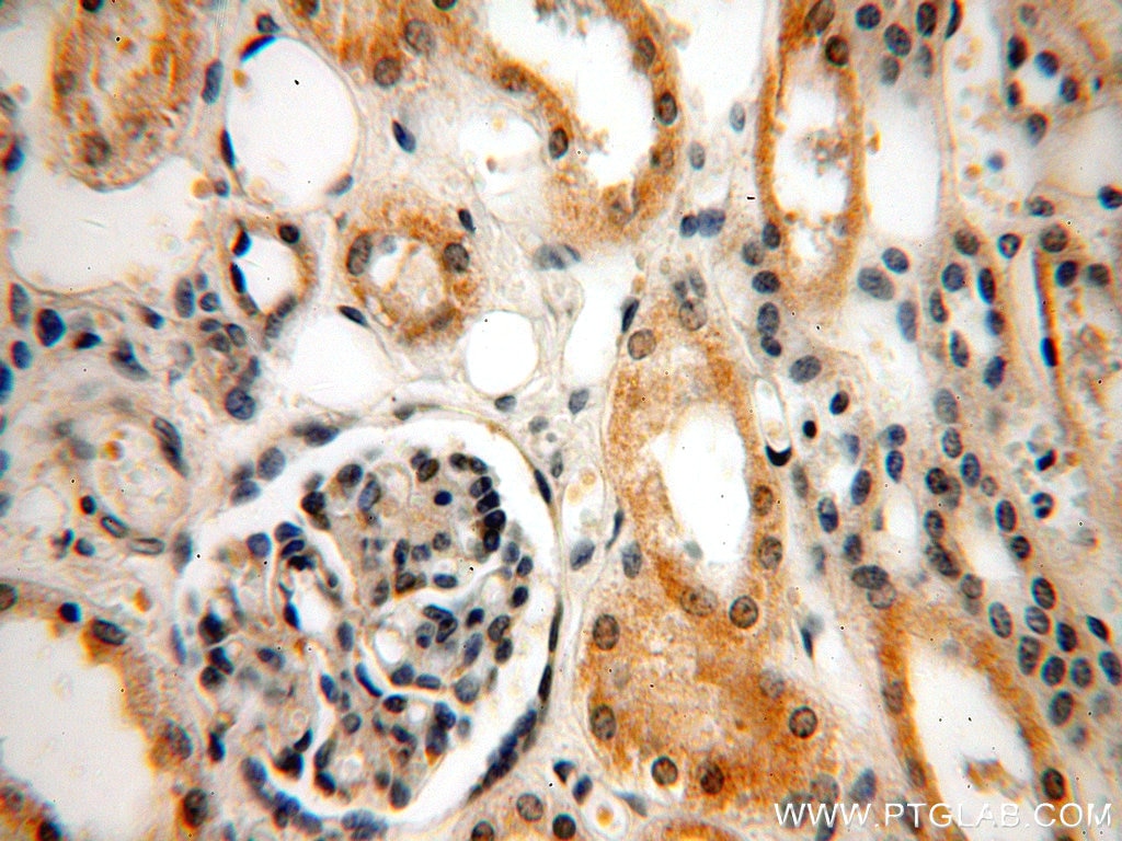 IHC staining of human kidney using 20466-1-AP