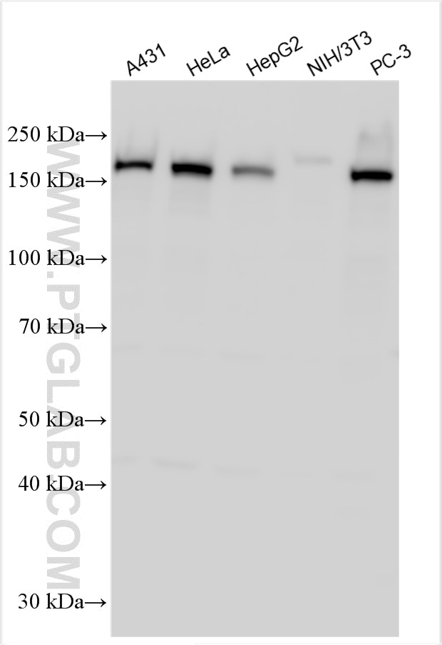 Western Blot (WB) analysis of various lysates using INF2 Polyclonal antibody (20466-1-AP)