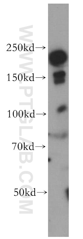Western Blot (WB) analysis of mouse brain tissue using INF2 Polyclonal antibody (20466-1-AP)