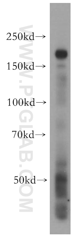 Western Blot (WB) analysis of HeLa cells using INF2 Polyclonal antibody (20466-1-AP)