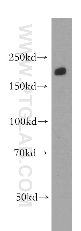 Western Blot (WB) analysis of NIH/3T3 cells using INF2 Polyclonal antibody (20466-1-AP)