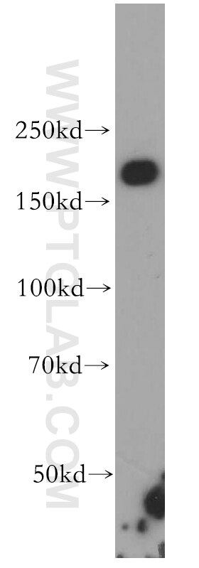 Western Blot (WB) analysis of A431 cells using INF2 Polyclonal antibody (20466-1-AP)