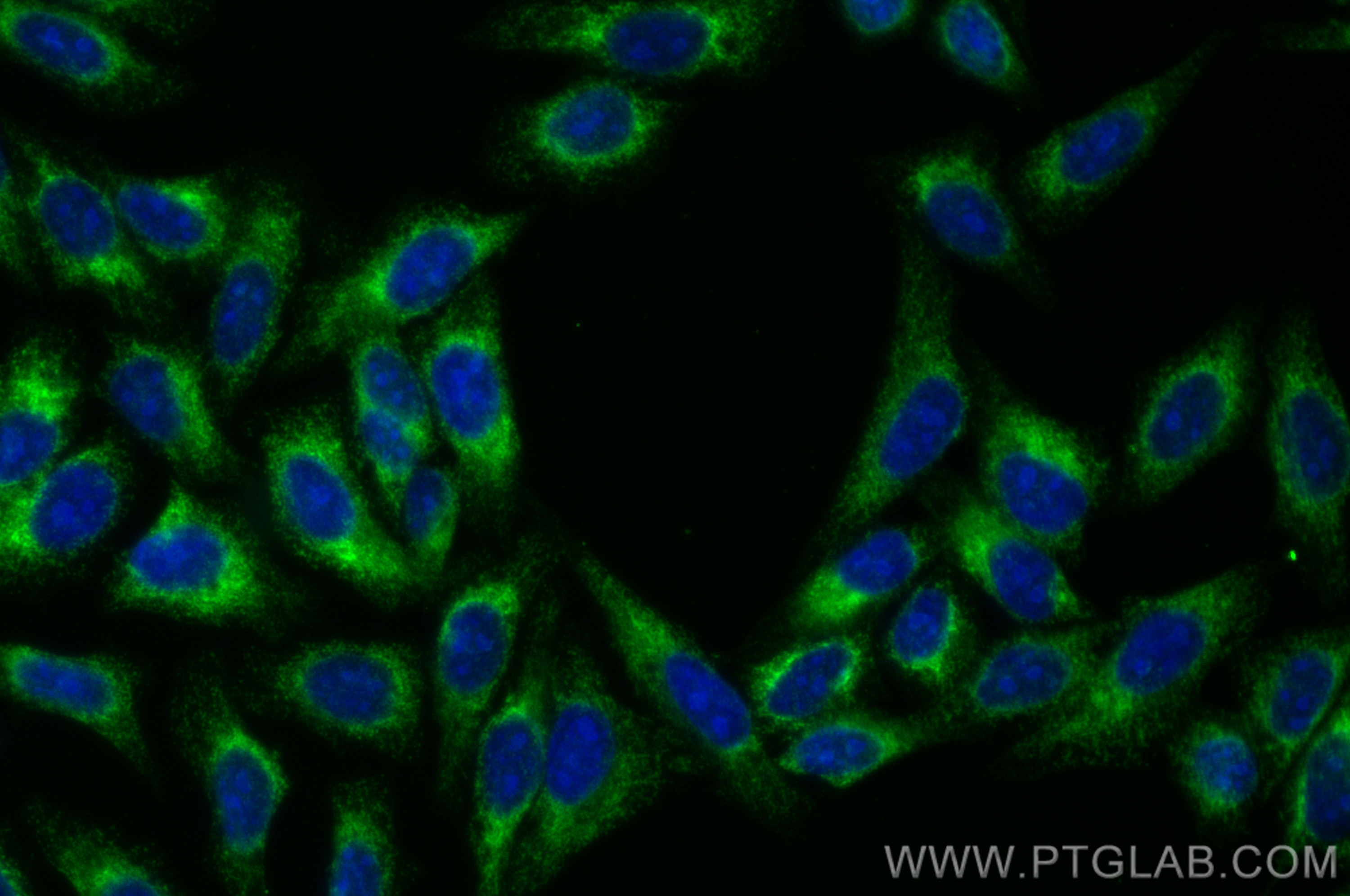 Immunofluorescence (IF) / fluorescent staining of HepG2 cells using INF2 Monoclonal antibody (66910-1-Ig)